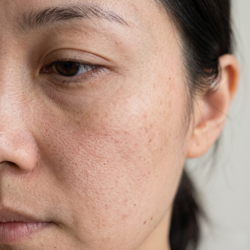 Skin close-up at days 1 to 7