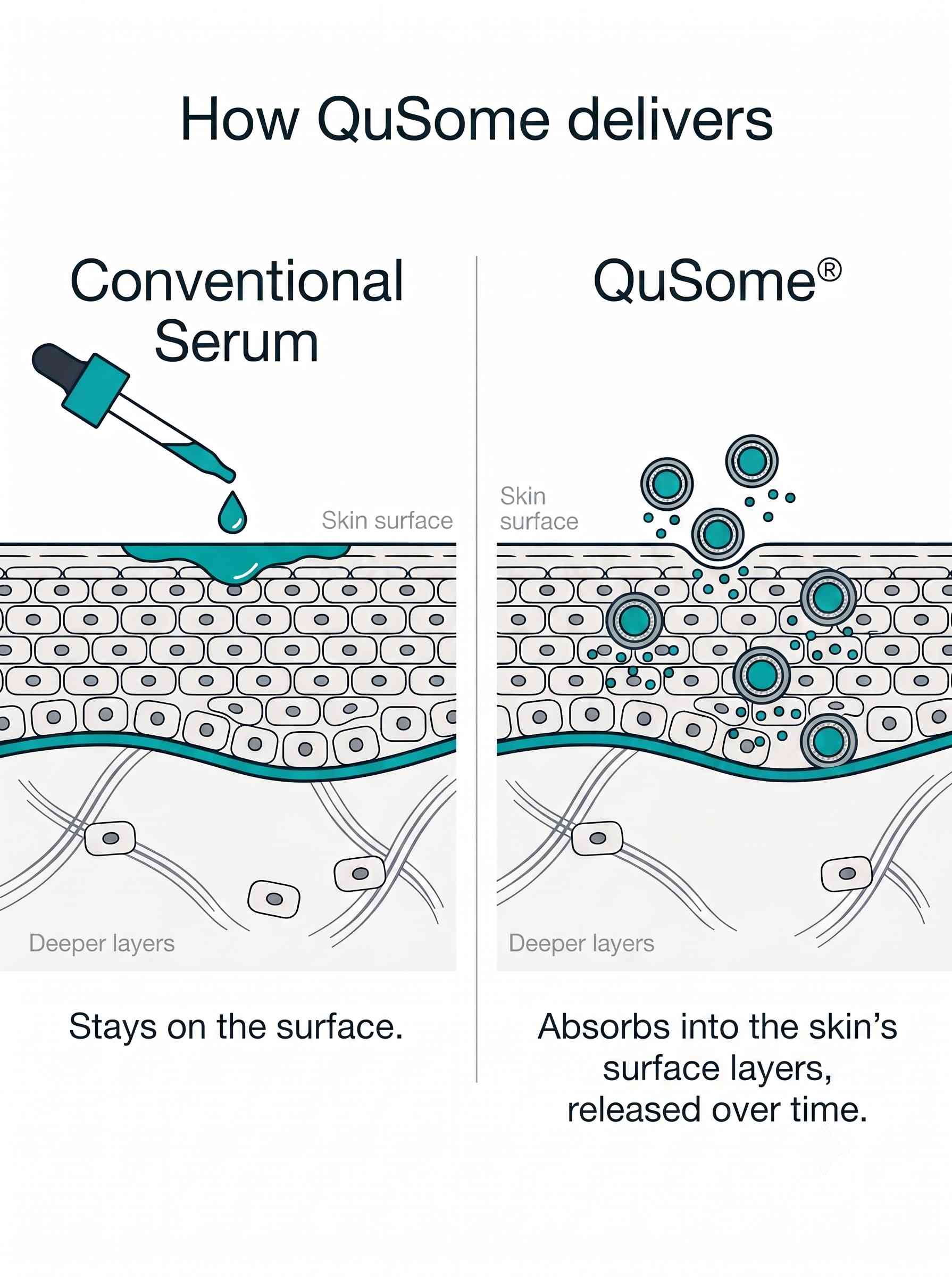 Skin cross-section comparison: a conventional serum stays on the surface, while QuSome capsules absorb into the skin's surface layers and release over time