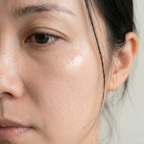 Skin close-up at week 8 to 12, full effect