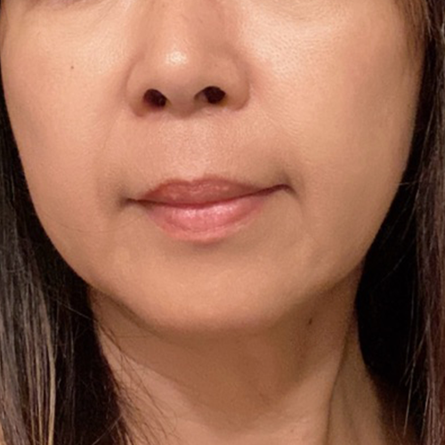 Firming Kit, skin after use