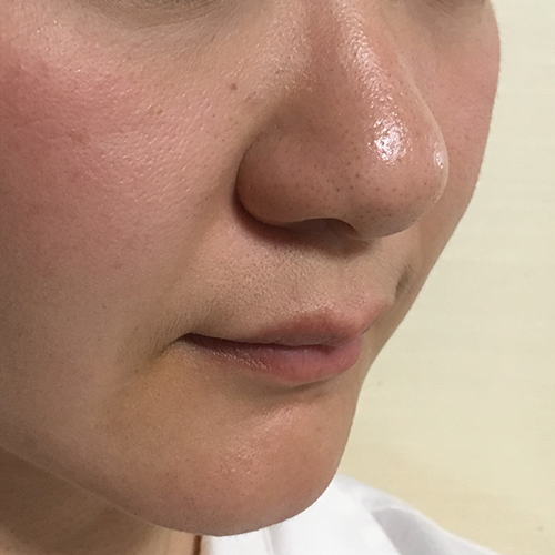 Firming Kit, skin before use