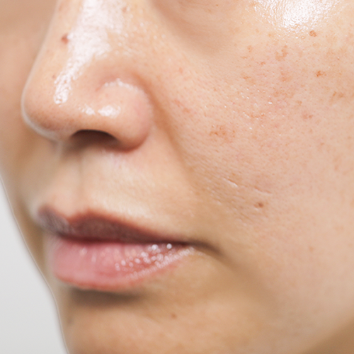 Firming Kit, skin after use