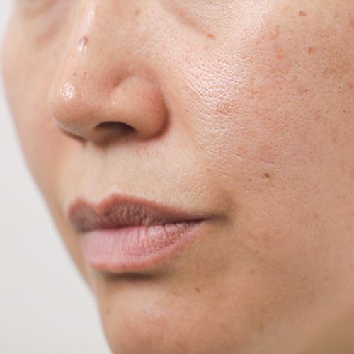 Firming Kit, skin before use