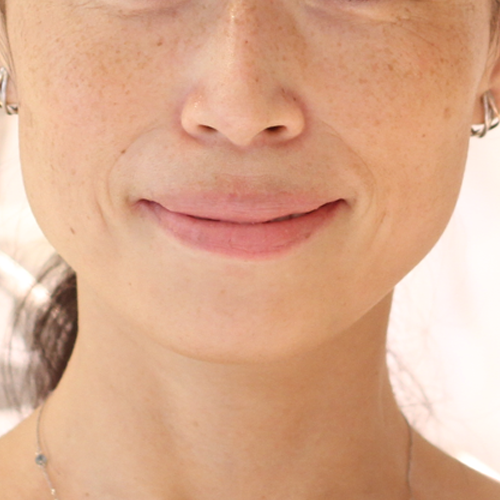 Brightening Kit, skin before use